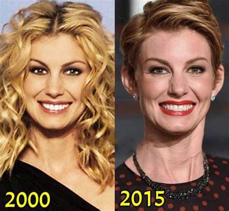 has faith hill had plastic surgery|Are Faith Hills plastic surgery rumours。